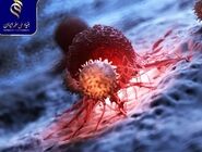 طراحی هیدروژل حساس به نور برای درمان ترکیبی سرطان سینه