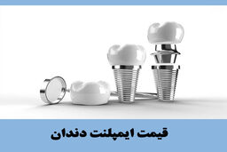 قیمت ایمپلنت دندان