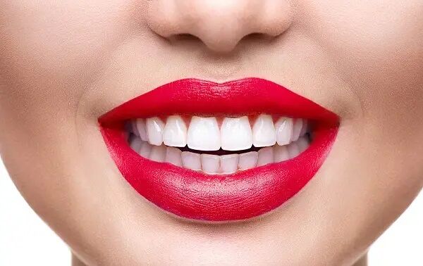 مقایسه کامپوزیت زنیت و توکویاما + قیمت و رنگبندی