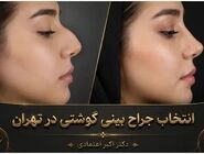 بینی گوشتی فقط مسئله اندازه نیست؛ پوست و غضروف چه نقشی در نتیجه جراحی دارند؟