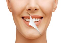 طراحی لبخند با روکش کردن دندان‌ها چگونه است؟